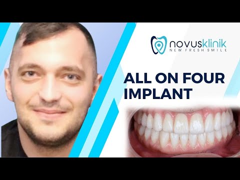 Logo of Affordable Dental Implants in Istanbul, Turkey – Cost, Clinics, and Patient Care