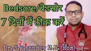 Bedsore/ बेडसोर care     Dr Skpandey M