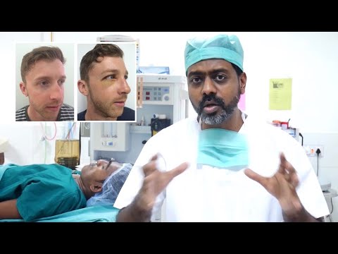 What Is Rhinoplasty?