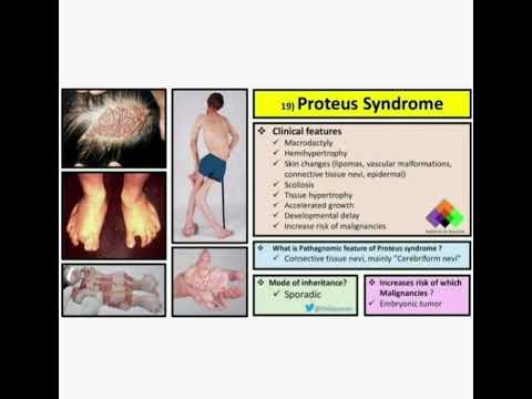 🌀 Proteus  syndrome 🌀