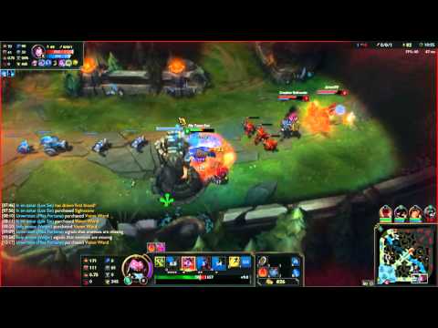 Kalays Eyes - Mundo Top (vs Malphite)