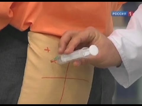 Коленный сустав боль при повороте Боли в пояснице и животе до и после месячных