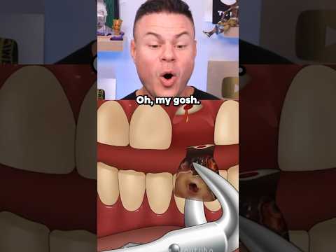 Dentist VS Rotten Tooth