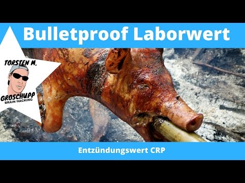 Was ist, wenn die Rückenschmerzen im Beckenbereich zu tun Übungen für die Halswirbelsäule Wirbel