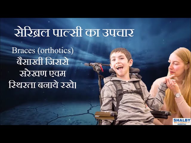 Cerebral Palsy Treatment Video 3