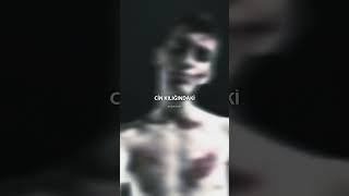 Allame'nin hastalığı