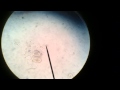 Discus Internal Parasites Poop Under Microscope