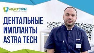Система дентальных имплантов AstraTech 🤔 Зубной имплант Астра Теч