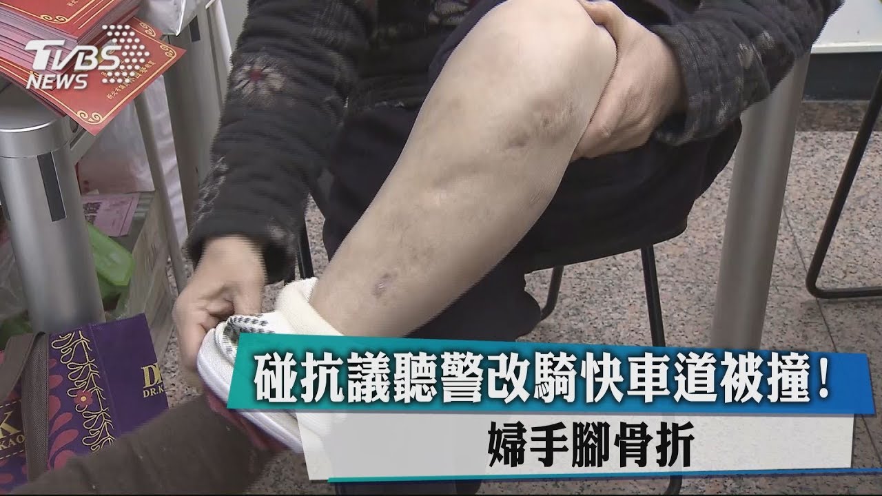 遇抗議聽警改騎「快車道」被撞 婦手腳骨折
