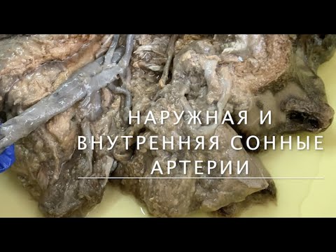 Наружная и внутренняя сонные артерии