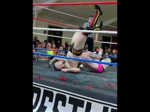 Love Doug Broke his neck