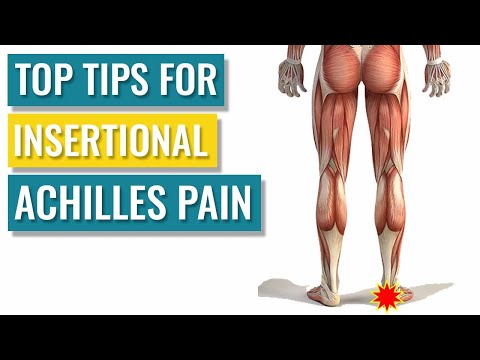 Top Tips for Insertional Achilles Tendinopathy