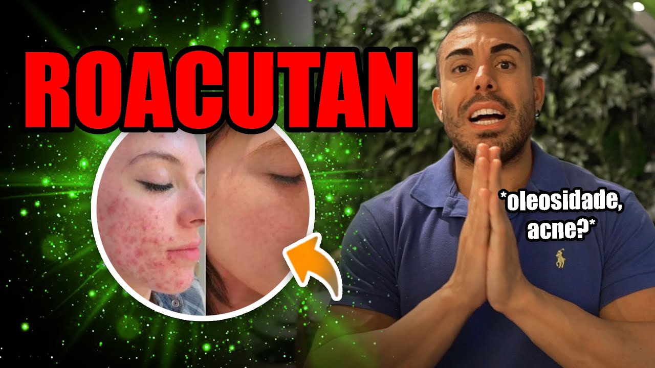 Tudo sobre Roacutan *atrapalha os resultados?*