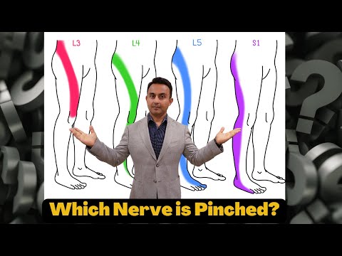 "Which nerve is pinched in my back?"