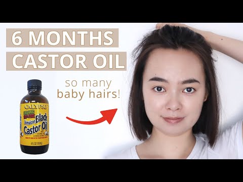 Part of a video titled Castor Oil 6-Months Update – Baby Hairs + Adding Rosemary Oil