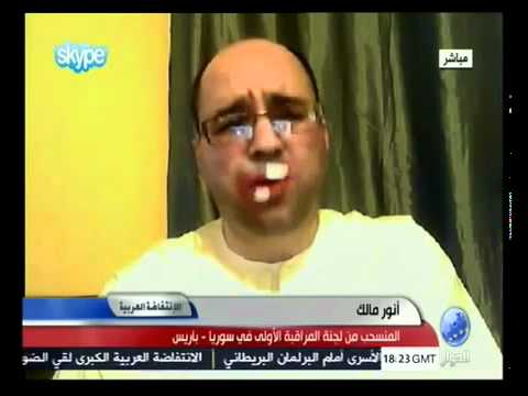 أنور مالك يتعرض للضرب المبرح من صهره و يتهم سوريا