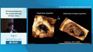 제10회 선천성심장병센터 심포지엄 : 3D echocardiography for surgical planning of heart valves 미리보기