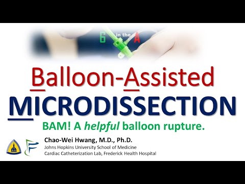 Balloon-Assisted Microdissection (BAM) bailout after sub-acute vessel closure