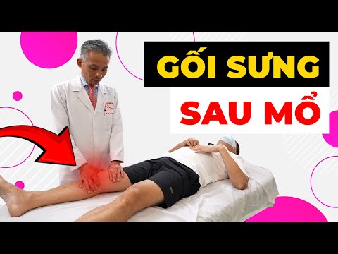 Gối Sưng Như Quả Bóng Sau Mổ - Sai Lầm Chết Người Bệnh Nhân Mắc Phải