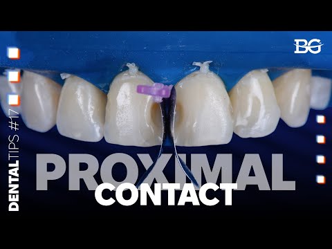How to create a perfect proximal contact in anterior teeth