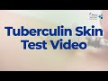 Tuberculin Skin Test Video - 2022