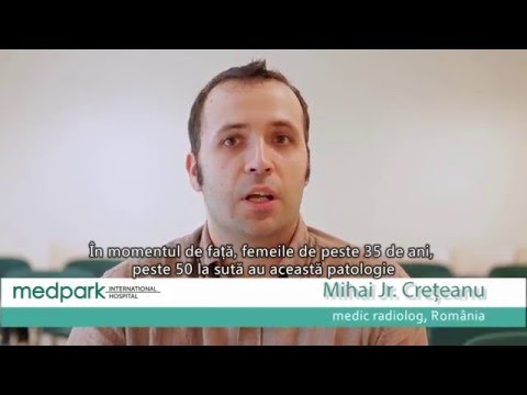 Embolizarea miomului uterin - soluția modernă, fără bisturiu