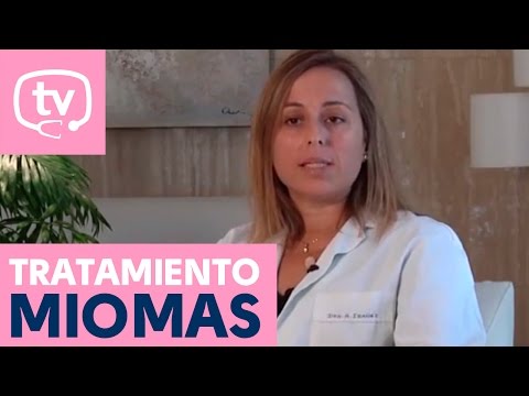 Tratamiento de los miomas