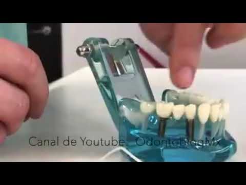 Uso de hilo dental en puentes