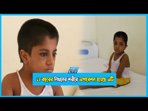 বিরল রোগ লিখনের, ১২ বছরে শরীরের হাড় ভেঙেছে ১০০ এর অধিক!