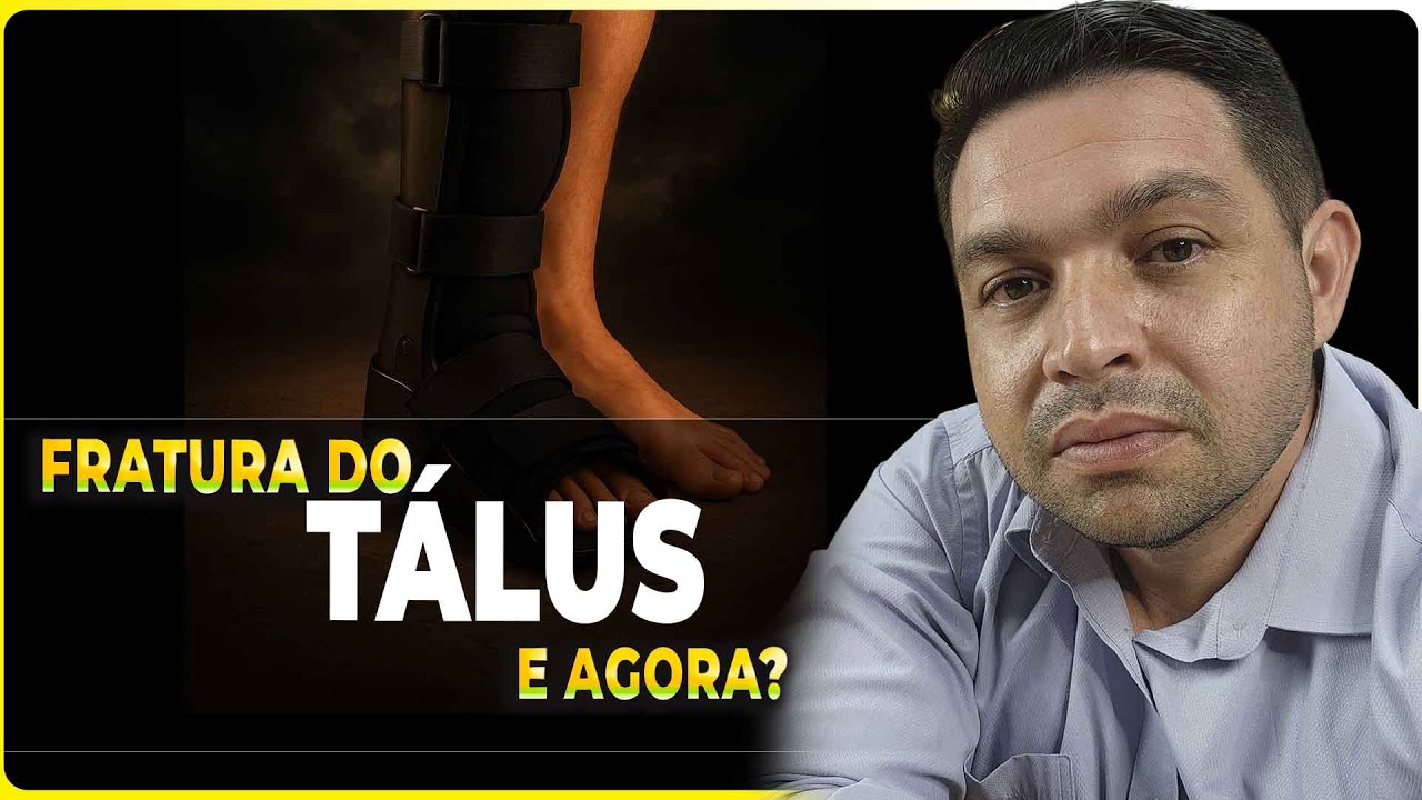 Tempo de recuperação da Fratura no TÁLUS e suas complicações