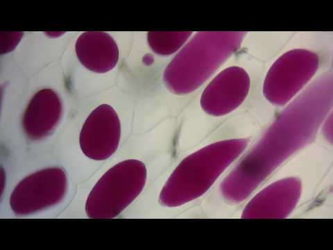 Flaccid - Definition and Examples - Biology Online Dictionary