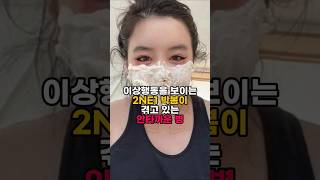 이상행동을 보이는 2NE1 박봄이 겪고 있는 안타까운 병 #박봄