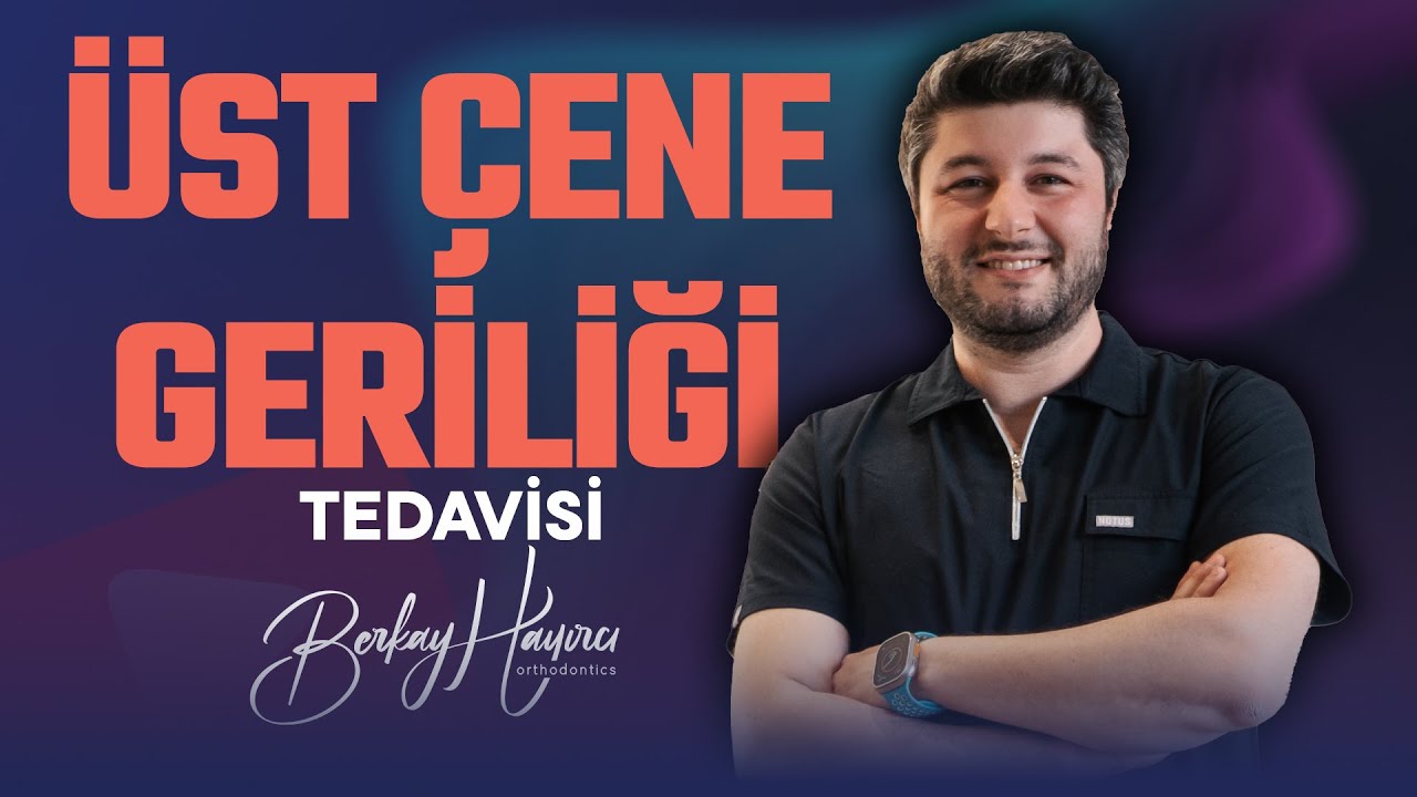 Üst Çene Geriliği Tedavisi