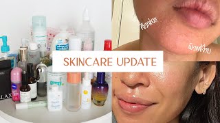 REVIEW l อัพเดตสกินแคร์ เป็นสิว ผิวมัน แพ้ง่าย midyear update 2022