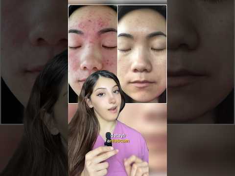 Cilt bariyer fonksiyonunu iyileştirici içerikler