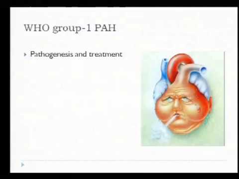Pulmonary Hypertension- Common Myths & Misconceptions- Dr. Sif Hansdottir, 7/17/13