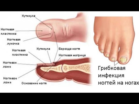 Die Behandlung gribka die Köpfe von der Salbe Das billigste Präparat von gribka auf den Beinen