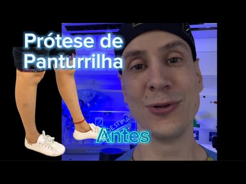 Como Engrossar a Perna - Prótese de Panturrilha fica Natural ?