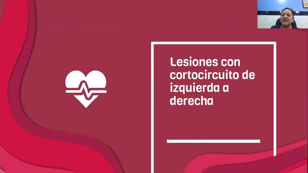 cardiopatias acianoticas