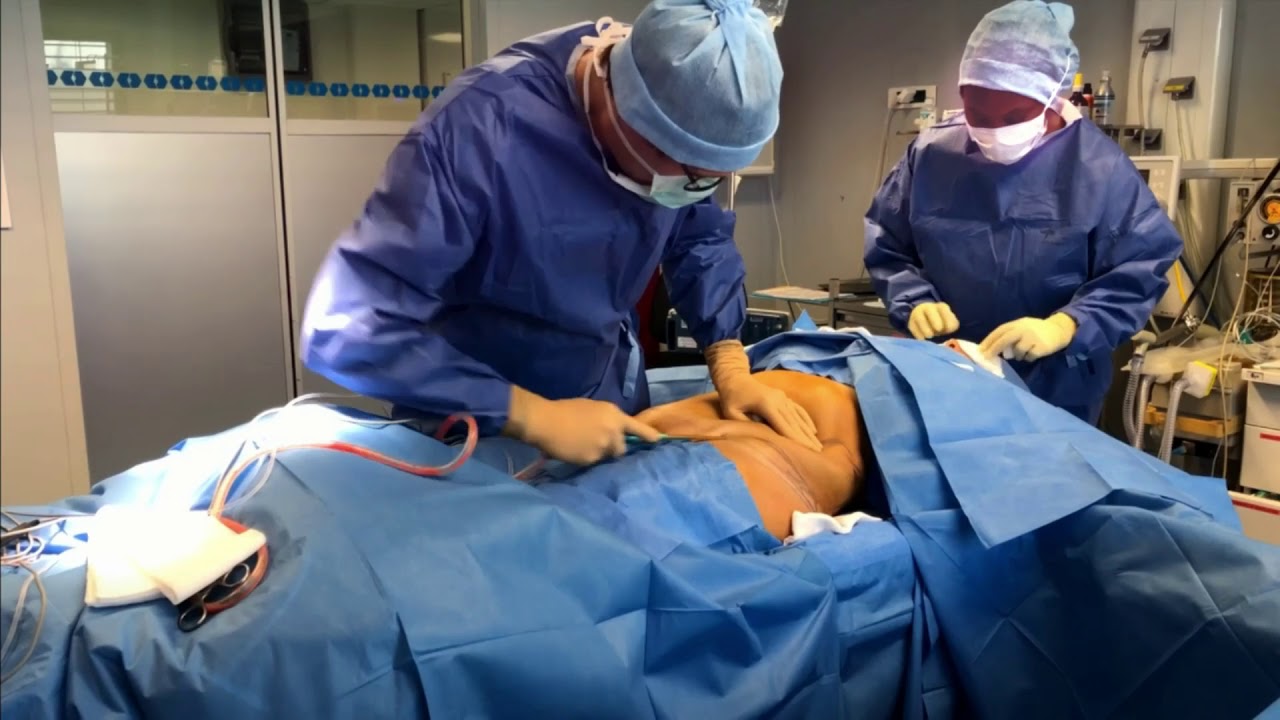 Comment se déroule l'opération de l'abdominoplastie?