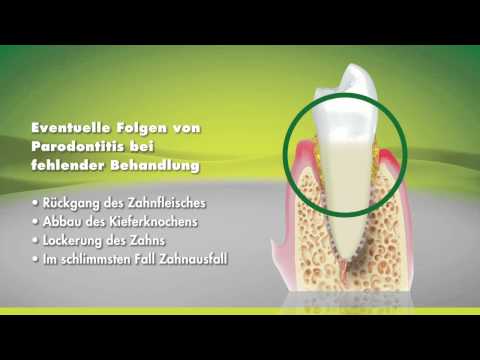 Praxis Dr. Erhard - Parodontologie-Regeneration