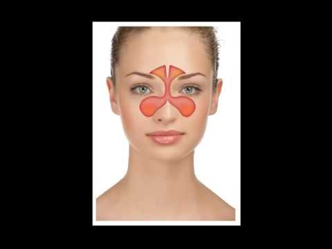 Levocetirizine Hydrochloride Pseudoephedrine Tablet