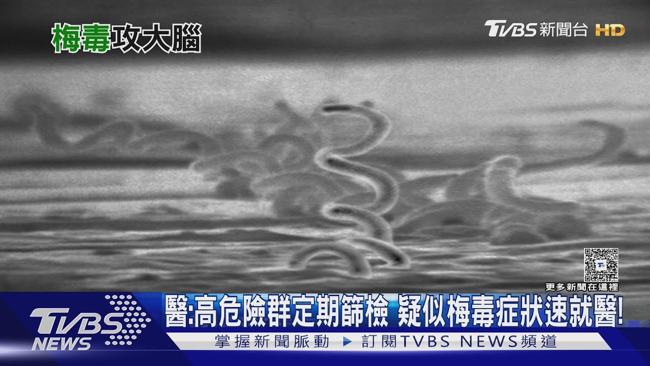 感染梅毒！盡速治療 醫師：延誤就醫　恐腦神經受損