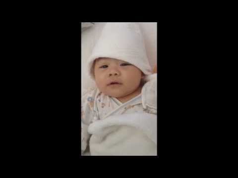 หน้าอกระเบิดหลังจาก mammoplasty Upsize ครีมหน้าอก