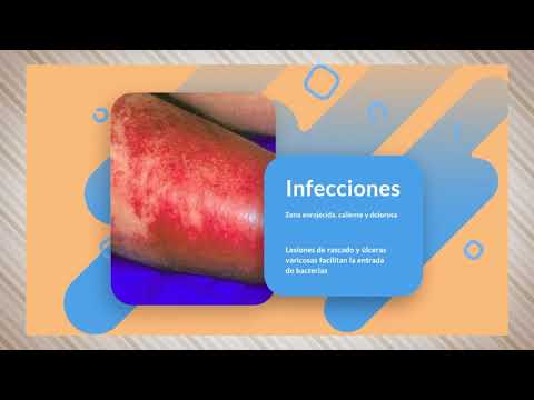 Cum să se comporte cu varicoză - Cum sa se comporte cu varicoza