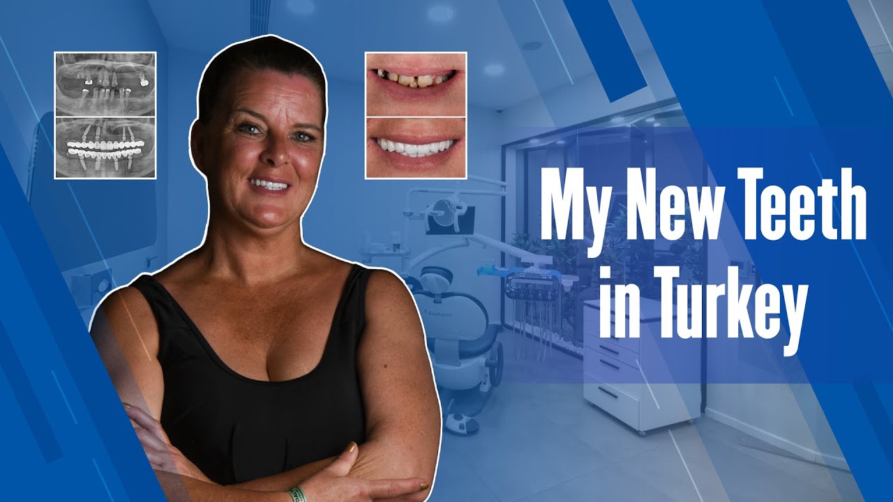 How to Get My New Teeth Done in Turkey? | Dentares Smile Clinic 2022