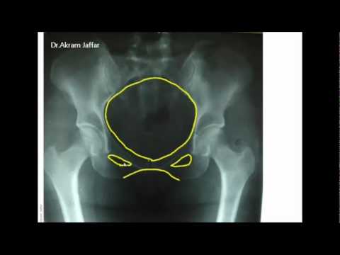 Anatomía de la cintura pélvica femenina