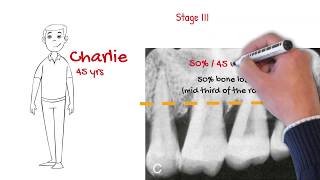 The new periodontal classification *MUST WATCH FOR ALL DENTISTS*