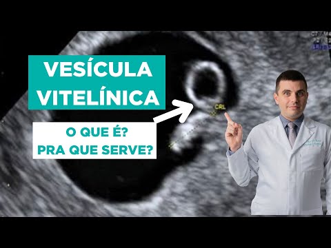 Vesícula Vitelínica - O Que É e Para Que Serve?