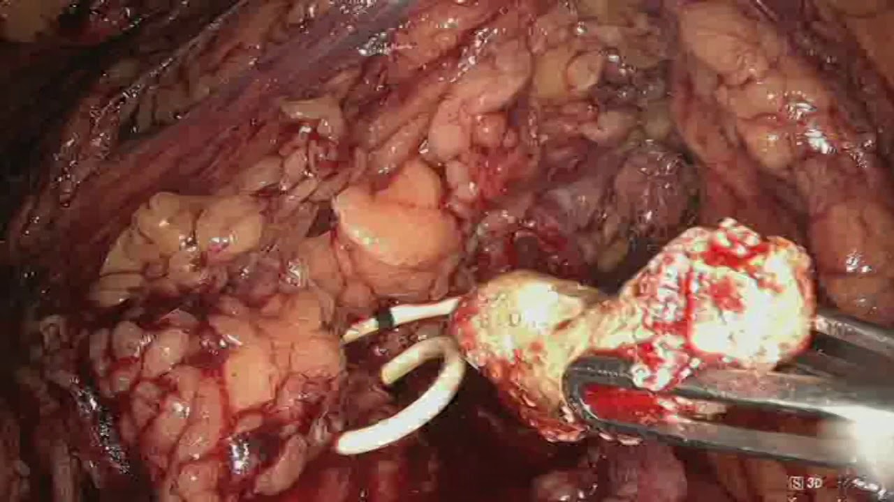 Francesco Chiaradia-9